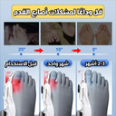 Correcteur Hallux avec Molette Réglable